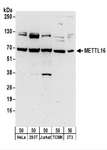 METTL16 / METT10D Antibody - Detection of Human and Mouse METTL16 by Western Blot. Samples: Whole cell lysate (50 ug) from HeLa, 293T, Jurkat, mouse TCMK-1, and mouse NIH3T3 cells. Antibodies: Affinity purified rabbit anti-METTL16 antibody used for WB at 0.1 ug/ml. Detection: Chemiluminescence with an exposure time of 3 minutes.