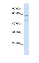 METTL16 / METT10D Antibody - 293T cell lysate. Antibody concentration: 1.0 ug/ml. Gel concentration: 12%.  This image was taken for the unconjugated form of this product. Other forms have not been tested.