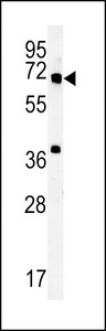 METTL16 / METT10D Antibody - MET10 Antibody western blot of mouse bladder tissue lysates (15 ug/lane). The MET10 antibody detected MET10 protein (arrow).