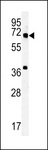 METTL16 / METT10D Antibody - MET10 Antibody western blot of mouse bladder tissue lysates (15 ug/lane). The MET10 antibody detected MET10 protein (arrow).