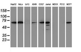 METTL16 / METT10D Antibody - Western blot of extracts (35ug) from 9 different cell lines by using anti-METT10D monoclonal antibody (HepG2: human; HeLa: human; SVT2: mouse; A549: human; COS7: monkey; Jurkat: human; MDCK: canine; PC12: rat; MCF7: human).