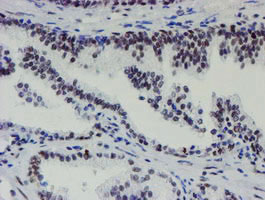 METTL16 / METT10D Antibody - IHC of paraffin-embedded Human prostate tissue using anti-METT10D mouse monoclonal antibody. (Heat-induced epitope retrieval by 10mM citric buffer, pH6.0, 100C for 10min).