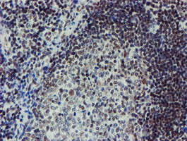 METTL16 / METT10D Antibody - IHC of paraffin-embedded Human tonsil using anti-METT10D mouse monoclonal antibody. (Heat-induced epitope retrieval by 10mM citric buffer, pH6.0, 100C for 10min).