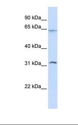 METTL16 / METT10D Antibody - Jurkat cell lysate. Antibody concentration: 1.0 ug/ml. Gel concentration: 12%.  This image was taken for the unconjugated form of this product. Other forms have not been tested.