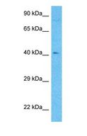 METTL22 / C16orf68 Antibody - Western blot of METTL22 Antibody with human 721_B Whole Cell lysate.  This image was taken for the unconjugated form of this product. Other forms have not been tested.