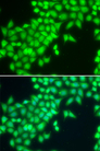 METTL2A Antibody - Immunofluorescence analysis of MCF7 cells.