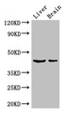 METTL2A Antibody - Western Blot Positive WB detected in: Mouse liver tissue, Mouse brain tissue All lanes: METTL2A antibody at 3µg/ml Secondary Goat polyclonal to rabbit IgG at 1/50000 dilution Predicted band size: 44, 28 kDa Observed band size: 44 kDa