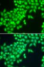 METTL2A Antibody - Immunofluorescence analysis of MCF-7 cells using METTL2A Polyclonal Antibody.