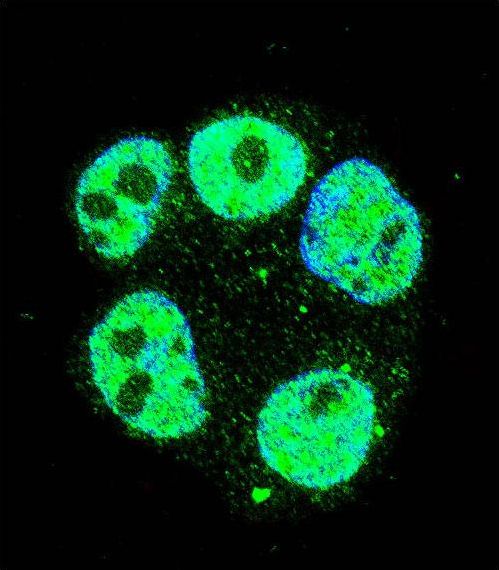 METTL2B Antibody - Confocal immunofluorescence of METTL2 Antibody with ZR-75-1 cell followed by Alexa Fluor 488-conjugated goat anti-rabbit lgG (green). DAPI was used to stain the cell nuclear (blue).