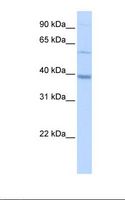 METTL2B Antibody - HepG2 cell lysate. Antibody concentration: 0.5 ug/ml. Gel concentration: 12%.  This image was taken for the unconjugated form of this product. Other forms have not been tested.