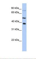 METTL2B Antibody - HepG2 cell lysate. Antibody concentration: 1.0 ug/ml. Gel concentration: 12%.  This image was taken for the unconjugated form of this product. Other forms have not been tested.