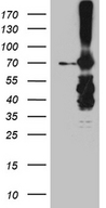 METTL3 Antibody - HEK293T cells were transfected with the pCMV6-ENTRY control. (Left lane) or pCMV6-ENTRY METTL3. (Right lane) cDNA for 48 hrs and lysed. Equivalent amounts of cell lysates. (5 ug per lane) were separated by SDS-PAGE and immunoblotted with anti-METTL3. (1:2000)