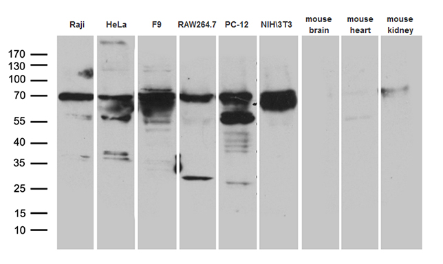 METTL3 Antibody - Western blot analysis of extracts. (35ug) from 6 different cell lines and 3 differenet tissue lysates by using anti-METTL3 monoclonal antibody. (1:500)