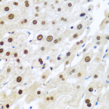 METTL3 Antibody - Immunohistochemistry of paraffin-embedded human liver tissue.