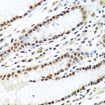 METTL3 Antibody - Immunohistochemistry of paraffin-embedded human stomach tissue.