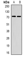 METTL3 Antibody - Western blot analysis of METTL3 expression in HepG2 (A); mouse spleen (B) whole cell lysates.