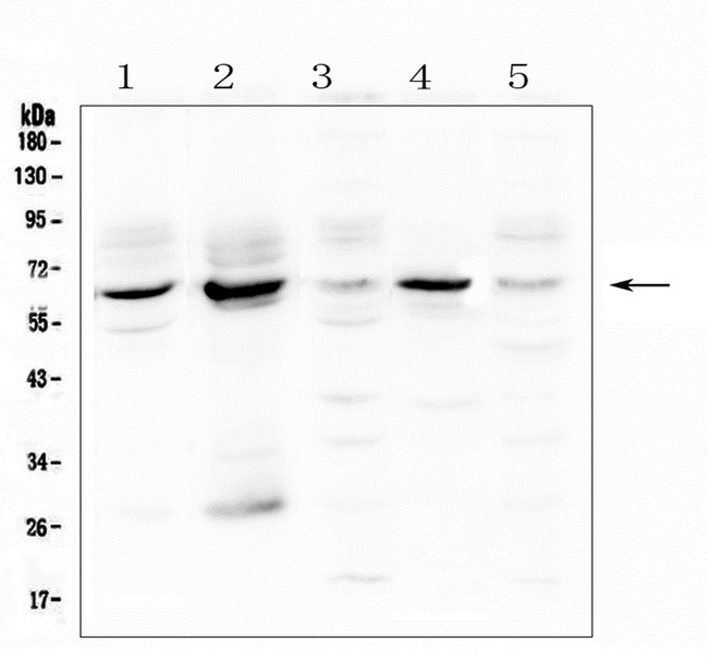 METTL3 Antibody - Western blot analysis of METTL3 using anti-METTL3 antibody. Electrophoresis was performed on a 5-20% SDS-PAGE gel at 70V (Stacking gel) / 90V (Resolving gel) for 2-3 hours. The sample well of each lane was loaded with 50ug of sample under reducing conditions. Lane 1: human placenta tissue lysates,Lane 2: human HepG2 whole cell lysate,Lane 3: human K562 whole cell lysate,Lane 4: human Hela whole cell lysate,Lane 5: human Caco-2 whole cell lysate. After Electrophoresis, proteins were transferred to a Nitrocellulose membrane at 150mA for 50-90 minutes. Blocked the membrane with 5% Non-fat Milk/ TBS for 1.5 hour at RT. The membrane was incubated with rabbit anti-METTL3 antigen affinity purified polyclonal antibody at 0.5 µg/mL overnight at 4°C, then washed with TBS-0.1% Tween 3 times with 5 minutes each and probed with a goat anti-rabbit IgG-HRP secondary antibody at a dilution of 1:10000 for 1.5 hour at RT. The signal is developed using an Enhanced Chemiluminescent detection (ECL) kit with Tanon 5200 system. A specific band was detected for METTL3 at approximately 64KD. The expected band size for METTL3 is at 64KD.