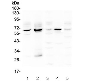 METTL3 Antibody - Western blot testing of human 1) placenta, 2) HepG2, 3) K562, 4) HeLa and 5) Caco-2 lysate with METTL3 antibody at 0.5ug/ml. Expected molecular weight: 64-70 kDa.