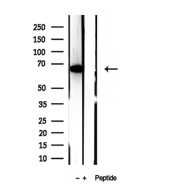 METTL3 Antibody - Western blot analysis of extracts of HEK293 cells using METTL3 antibody.