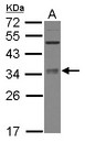 METTL6 Antibody - Sample (30 ug of whole cell lysate) A: IMR32 12% SDS PAGE METTL6 antibody diluted at 1:3000