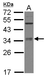 METTL6 Antibody - Sample (30 ug of whole cell lysate) A: IMR32 12% SDS PAGE METTL6 antibody diluted at 1:3000