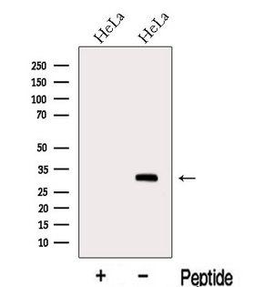 METTL6 Antibody - Western blot analysis of extracts of HeLa cells using METTL6 antibody. The lane on the left was treated with blocking peptide.