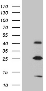 METTL7A Antibody - HEK293T cells were transfected with the pCMV6-ENTRY control. (Left lane) or pCMV6-ENTRY METTL7A. (Right lane) cDNA for 48 hrs and lysed. Equivalent amounts of cell lysates. (5 ug per lane) were separated by SDS-PAGE and immunoblotted with anti-METTL7A. (1:2000)
