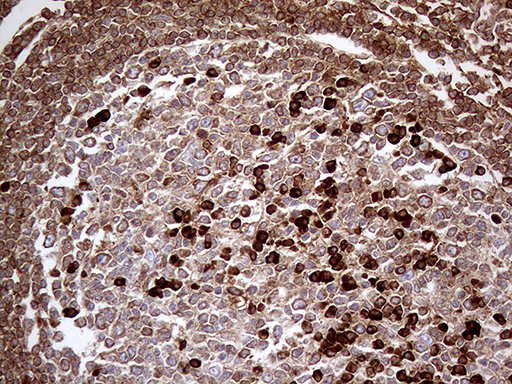 METTL7A Antibody - Immunohistochemical staining of paraffin-embedded Human lymph node tissue within the normal limits using anti-METTL7A mouse monoclonal antibody. (Heat-induced epitope retrieval by 1mM EDTA in 10mM Tris buffer. (pH8.5) at 120°C for 3 min. (1:2000)