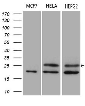 METTL7A Antibody - Western blot analysis of extracts. (35ug) from 3 different cell lines by using anti-METTL7A monoclonal antibody. (1:500)