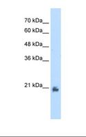 METTL7A Antibody - Transfected 293T cell lysate. Antibody concentration: 2.5 ug/ml. Gel concentration: 12%.  This image was taken for the unconjugated form of this product. Other forms have not been tested.