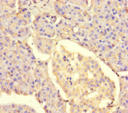 METTL7A Antibody - Immunohistochemistry of paraffin-embedded human pancreatic tissue using METTL7A Antibody at dilution of 1:100