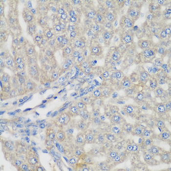 METTL7A Antibody - Immunohistochemistry of paraffin-embedded rat liver tissue.