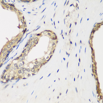 METTL7A Antibody - Immunohistochemistry of paraffin-embedded human prostate.