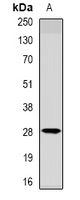 METTL7A Antibody - Western blot analysis of METTL7A expression in 22RV1 (A) whole cell lysates.