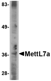METTL7A Antibody - Western blot of MettL7A in A-20 cell lysate with MettL7A antibody at 2 ug/ml