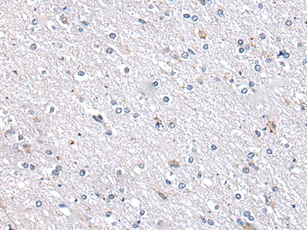 METTL7A Antibody - Immunohistochemistry of paraffin-embedded Human brain tissue  using METTL7A Polyclonal Antibody at dilution of 1:40(×200)