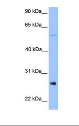 METTL7B Antibody - Jurkat cell lysate. Antibody concentration: 1.0 ug/ml. Gel concentration: 12%.  This image was taken for the unconjugated form of this product. Other forms have not been tested.
