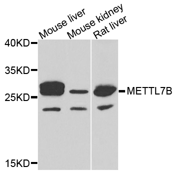 METTL7B Antibody - Western blot analysis of extracts of various cells.