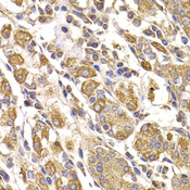 METTL7B Antibody - Immunohistochemistry of paraffin-embedded human stomach tissue.