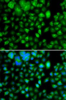 METTL7B Antibody - Immunofluorescence analysis of A549 cells.