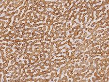 METTL7B Antibody - Immunochemical staining of human METTL7B in human liver with rabbit polyclonal antibody at 1:100 dilution, formalin-fixed paraffin embedded sections.