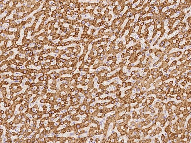 METTL7B Antibody - Immunochemical staining of human METTL7B in human liver with rabbit polyclonal antibody at 1:100 dilution, formalin-fixed paraffin embedded sections.