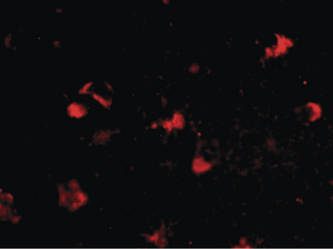 MEX3A Antibody - Immunofluorescence of rkhd4 in human brain tissue with rkhd4 antibody at 20 ug/ml.
