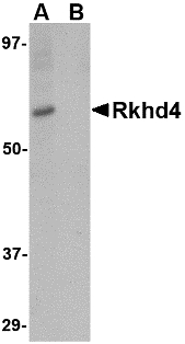 MEX3A Antibody - Western blot of Rkhd4 in SK-N-SH cell lysate with Rkhd4 antibody at 1 ug/ml in (A) the absence and (B) the presence of blocking peptide