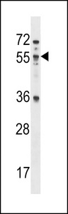 MEX3B / RKHD3 Antibody - MEX3B Antibody western blot of NCI-H460 cell line lysates (35 ug/lane). The MEX3B antibody detected the MEX3B protein (arrow).