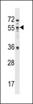 MEX3B / RKHD3 Antibody - MEX3B Antibody western blot of NCI-H460 cell line lysates (35 ug/lane). The MEX3B antibody detected the MEX3B protein (arrow).