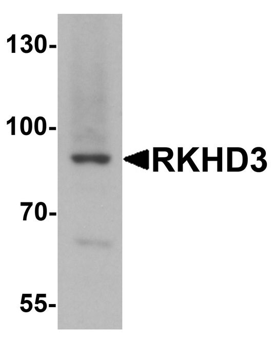 MEX3B / RKHD3 Antibody - Western blot analysis of RKHD3 in mouse skeletal muscle tissue lysate with RKHD3 antibody at 1 ug/ml.