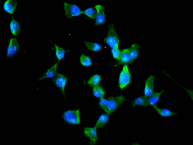MEX3B / RKHD3 Antibody - Immunofluorescence staining of SH-SY5Y cells diluted at 1:100, counter-stained with DAPI. The cells were fixed in 4% formaldehyde, permeabilized using 0.2% Triton X-100 and blocked in 10% normal Goat Serum. The cells were then incubated with the antibody overnight at 4°C.The Secondary antibody was Alexa Fluor 488-congugated AffiniPure Goat Anti-Rabbit IgG (H+L).