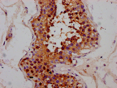 MEX3B / RKHD3 Antibody - Immunohistochemistry Dilution at 1:300 and staining in paraffin-embedded human testis tissue performed on a Leica BondTM system. After dewaxing and hydration, antigen retrieval was mediated by high pressure in a citrate buffer (pH 6.0). Section was blocked with 10% normal Goat serum 30min at RT. Then primary antibody (1% BSA) was incubated at 4°C overnight. The primary is detected by a biotinylated Secondary antibody and visualized using an HRP conjugated SP system.