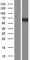 MEX3B / RKHD3 Protein - Western validation with an anti-DDK antibody * L: Control HEK293 lysate R: Over-expression lysate